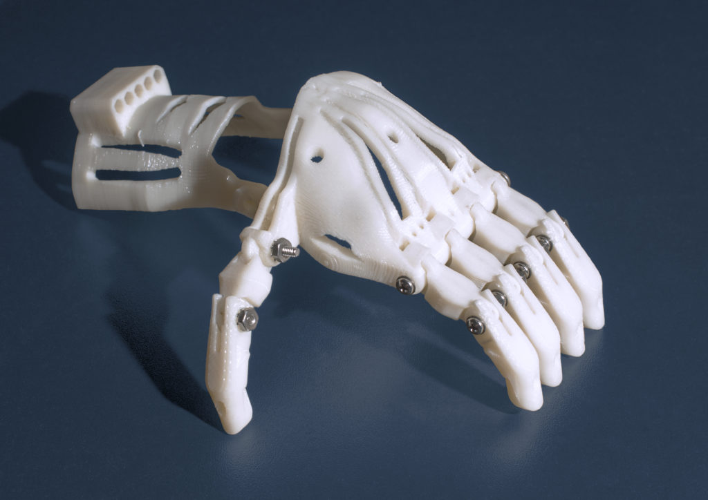 3 D Printed Prosthetic Hand Blue (5229) (18492491235)